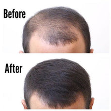 Load image into Gallery viewer, Thick Fiber Hair Building Fibers for Thinning and Fine hair - Grey
